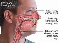 Rinita Alergica (Febra Fanului): Cauze - Simptome - Tratament