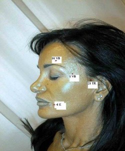 mezoterapie faciala